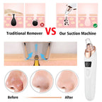 Pore Vacuum & Acne Extractor