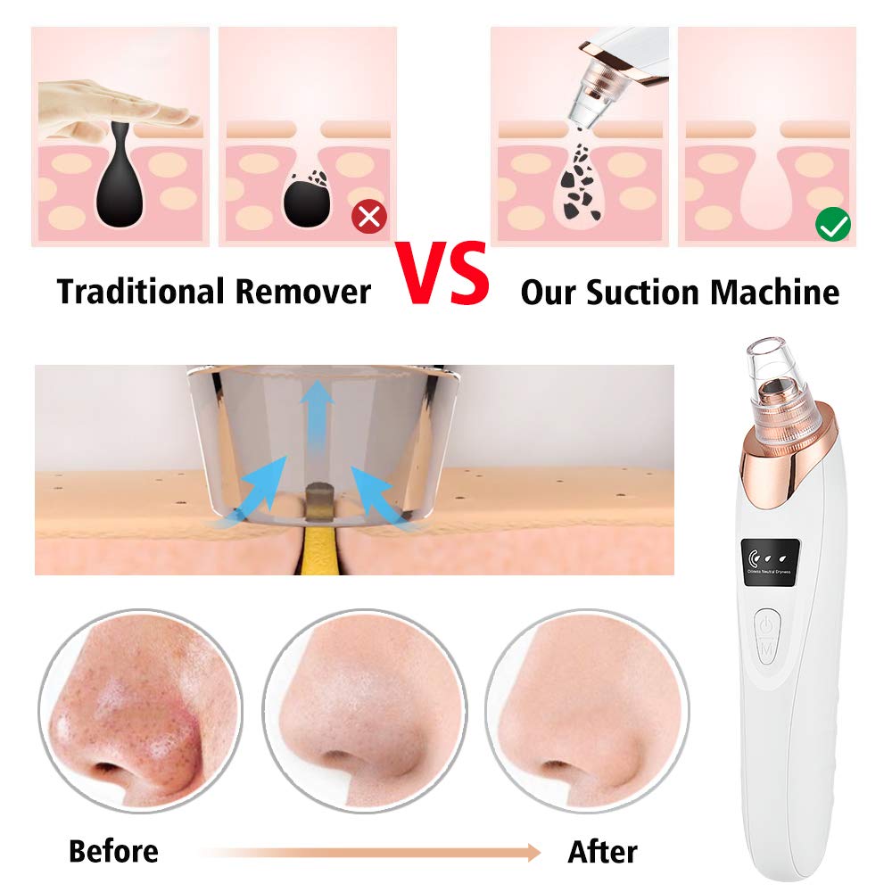 Pore Vacuum & Acne Extractor